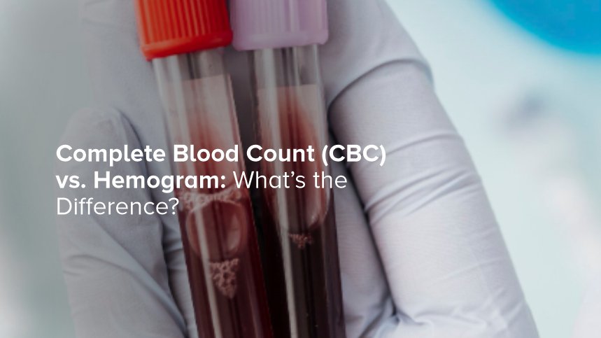 Complete Blood Count (CBC) vs. Hemogram: What’s the Difference?